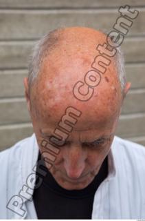 Old man bald head 0007